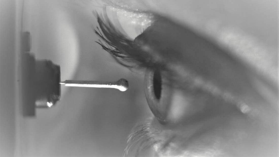 Ästhesiometer zur Messung der Hornhautsensibilität